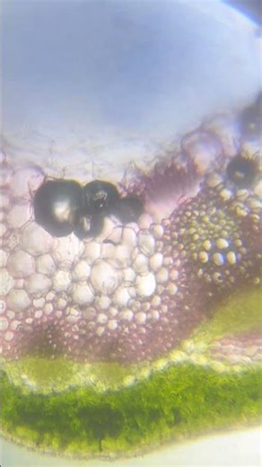 Anatomy of dicot stem