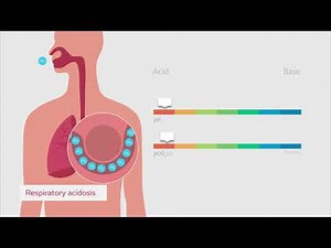 Understanding the acid-base balance (PL) – Radiometer