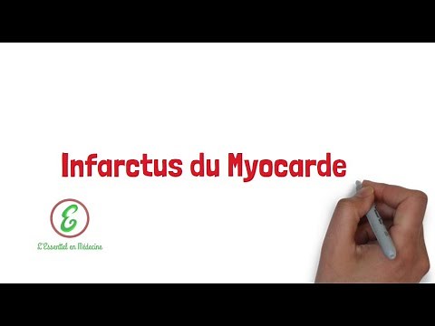 L'Essentiel sur l'Infarctus du Myocarde