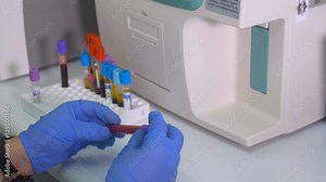 Lab technician operating test tubes, testing blood samples in laboratory using modern medical equipment. 4K. Stock Video