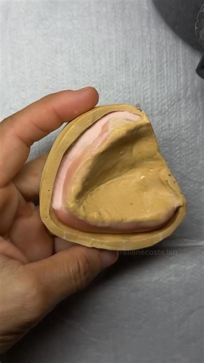 Base plate and wax rim❤️ #dentistry #dentist #teeth | Dental Videos