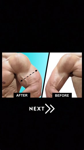 Effective Workouts for Bigger Arms