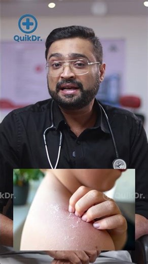 കുട്ടികൾക്ക് skin ചൊറിച്ചിലും allergyയും ഉണ്ടോ? | Do Children Get Skin Allergies and Itching?
