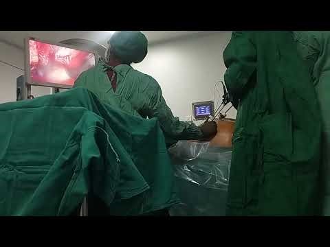 Laparoscopy Procedure #Laparoscopy#LaparoscopicSurgery #Surgery#Medical#Healthcare