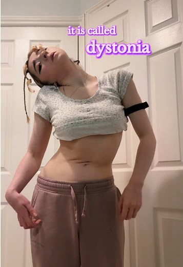 Understanding Dystonia: Truncal and Cervical Dystonia Explained