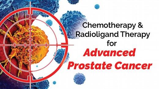 VIDEO: Chemotherapy and Radioligand Therapy for Advanced Prostate Cancer