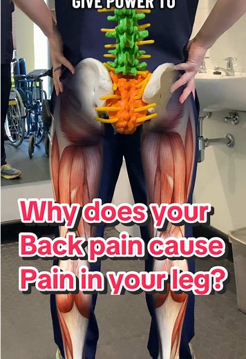 Understanding Sciatica: Back Pain Shooting Down Leg