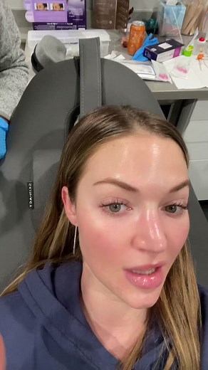 Runway Laser Melasma Treatment: PCOS & Melasma Solution