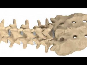 Minimally Invasive Transforaminal Interbody Fusion (TLIF)