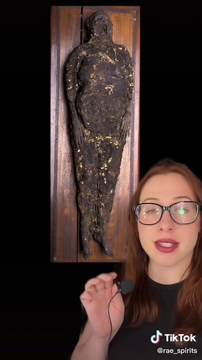 The Soap Lady of Mütter Museum: Creepy Facts Revealed