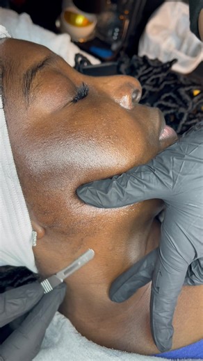 Dermaplane Techniques: Wet vs Dry Methods