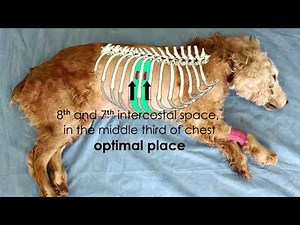 Thoracocentesis Emergency Medicine procedure