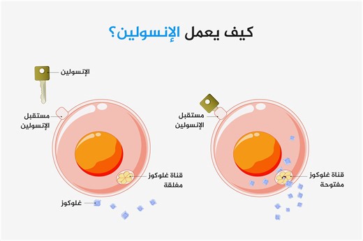 تغير لون جلد الرقبة والإبط للبني الغامق منها.. هذه علامات مقاومة الإنسولين
