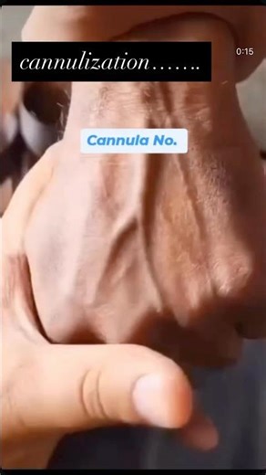 How to canalisation #health #healthcare #healthandwellness #healthknowledge ￼