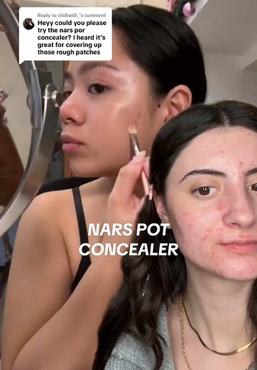 NARS Concealer Review: Best For Acne-Prone Skin