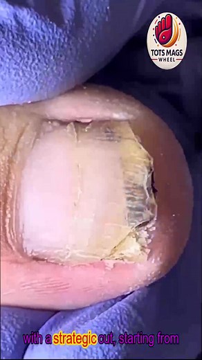 73K views · 258 reactions | Daily toenail care for long nails with soft at-home routines  #NailCareBasics #SoftCareGuide #EverydayFootComfort | Tots Mags Wheel | Facebook