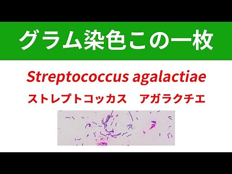 今日のグラム染色この一枚 Streptococcus agalactiaeによる菌血症