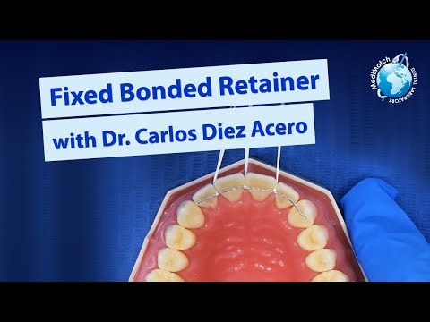PROTOCOL ★ Fixed Bonded Orthodontic Retainers