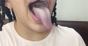Aesthetic Uvulas  on Instagram: "Another great video from the amazing @i_am_bilquis ! Give her a follow and check out her page! #Uvula #Epiglottis #Mouth #Tonsils #Tongue #LongTongue #TongueOut #TongueTricks #Teeth #Lips"