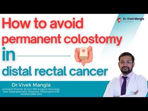 Can Rectal Cancer Be Treated Without Permanent Colostomy? | Dr. Vivek Mangla