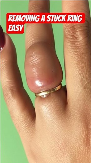 How to easily remove a stuck ring from your finger using a simple trick