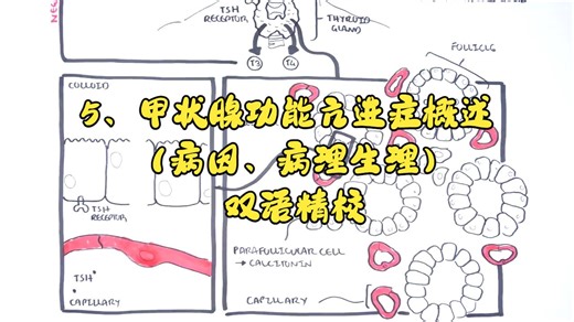 5、甲状腺功能亢进症概述（病因、病理生理）〖Armando Hasudungan〗双语精校