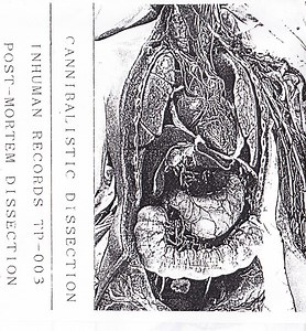 Cannibalistic Dissection - Post-mortem Dissection