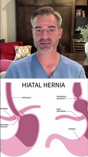 Hiatal Hernia Explained: Stomach Issues Revealed! #shorts