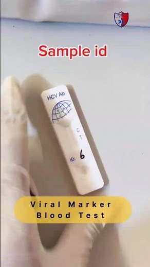 HCV Blood test || viral marker test || #hcv #blood #test #viral #markers ‪@robothealth‬