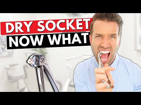 DRY SOCKET - Pain after tooth extraction : causes and cure