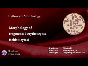 Morphology of fragmented erythrocytes (schistocytes)