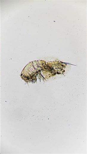 Macro footage of a rotifer under a microscope