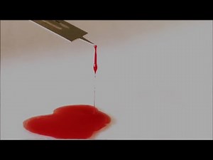 Determination of Blood Clotting Time By Slide Method | Blood Clotting Time Determination | ENGLISH