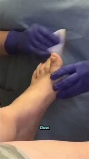 Fungus Re-infection The Crucial Step Your Doctor Might Miss