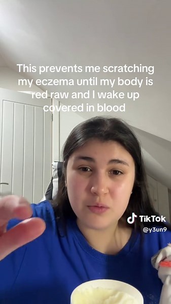 Understanding Eczema Management and Treatment Strategies