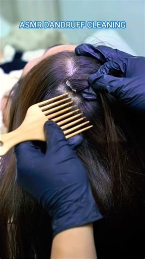 Asmr dandruff scratching #asmr #asmrdandruffscratching #asmrscalpcheck ‪@AngelicLofiASMR‬
