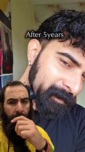 5 years of beard growth gone and left with an awkward mustache! #beardlaw