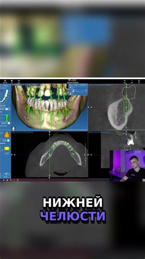 Secrets of Dentistry: Jaw Modeling and Tooth Movement! 🦷