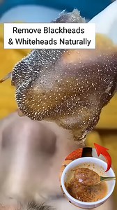 362K views · 1.9K reactions | Remove Blackheads & Whiteheads Naturally At Home . . . #blackheads #whiteheads #blackheadsremoval #whiteheadsremoval #skincare #reelsvideoシ #fbreelsfypシ゚ #reelsviralシ #fbreelsfypシ゚viralシ #reelschallenge #explorepage | Divine Beauty Tips | Facebook