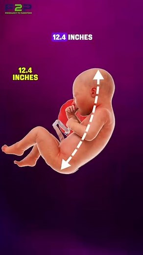 How Big Is a 34 Week Fetus?🌱👶 | Pregnancy to parenting