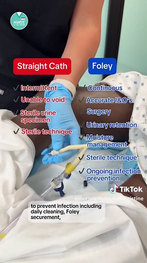 Straight Cath vs Foley 👉Straight Catheters = in & out 👉Indwelling (Foley) Catheter = stays in place for continuous drainage 👉Both require sterile technique #nurseskills #foleycatheter #straightcath #clinicaltips #steriletechnique