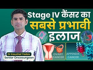 HIPEC Surgery Explained: Cytoreductive Surgery + HIPEC. Best treatment for stage IV Cancer