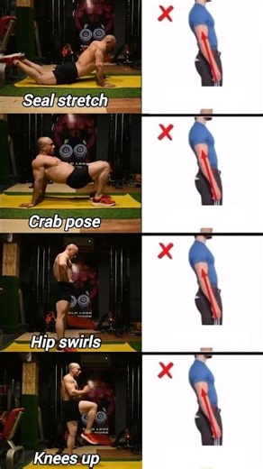 "Transform Your Posture: Fix Anterior Pelvic Tilt Easily! 🌟"