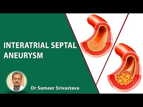 Signficane of interatrial septal aneurysm? | Dr. Sameer Srivastav | Medtalks
