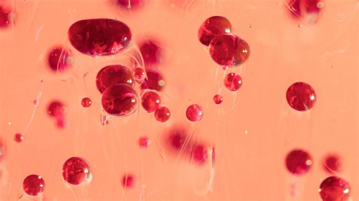 What is Haemophilia A? Causes, Signs, Treatment