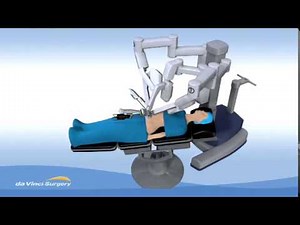 Single-Site Robotic Gallbladder Surgery
