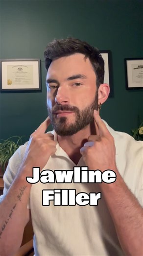 Kevin Forsell on Instagram: "Want a jawline like the movie stars? This reel shows a cannula approach to jawline enhancement, commonly requested by male patients for a sharper, more defined profile, but equally beneficial for women who want improved contour which doesn’t have to look “masculine”. Anatomy is always first consideration. I keep placement superficial to avoid the facial artery, which runs beneath the mandible approximately one to two inches in front of the angle of the jaw. Using a c