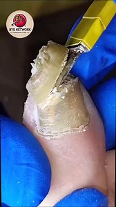 Gentle Ways to Support Brittle Toenails For Active Daily Routines #NailCareTips #FootWellnessUSA #EverydayCare #HealthyHabits | Bye