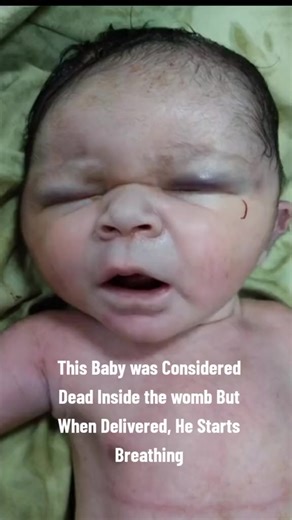 508 reactions · 41 comments | Miracle baby was thought to be unalive in the womb but started crying immediately after birth. It's amazing, this baby is unstoppable  #viralreelsfb #fypシ #cutebaby | Cynthia Godwin Abang | Facebook