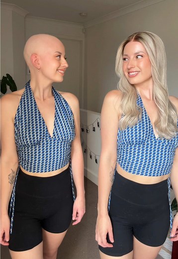 Alopecia Solutions: Embrace Confidence with Natural Wigs